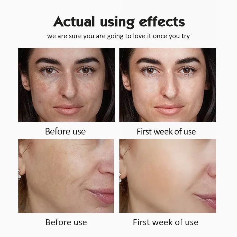 20% Vitamin C Brightening Facial Ampoule Serum