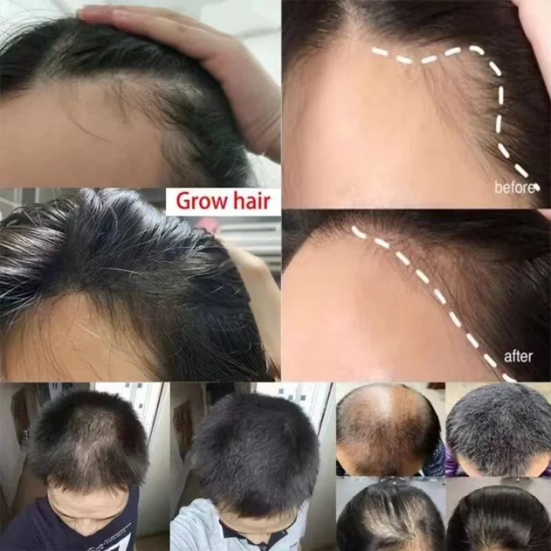 Ginger Scalp Care & Nourishing Hair Serum Spray
