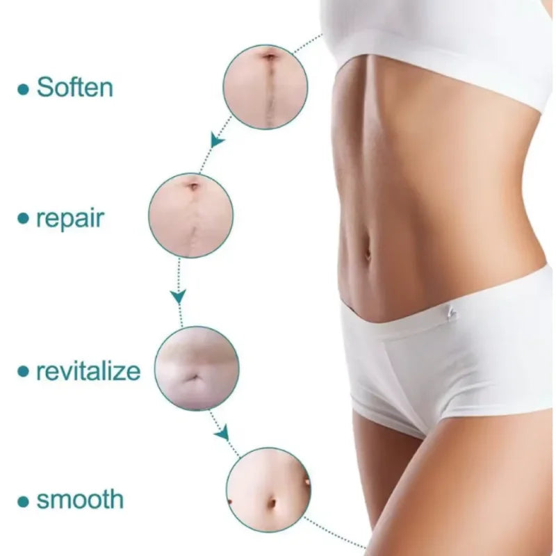 Silicone Scar Sheet – Reusable Silicone Scar Tape