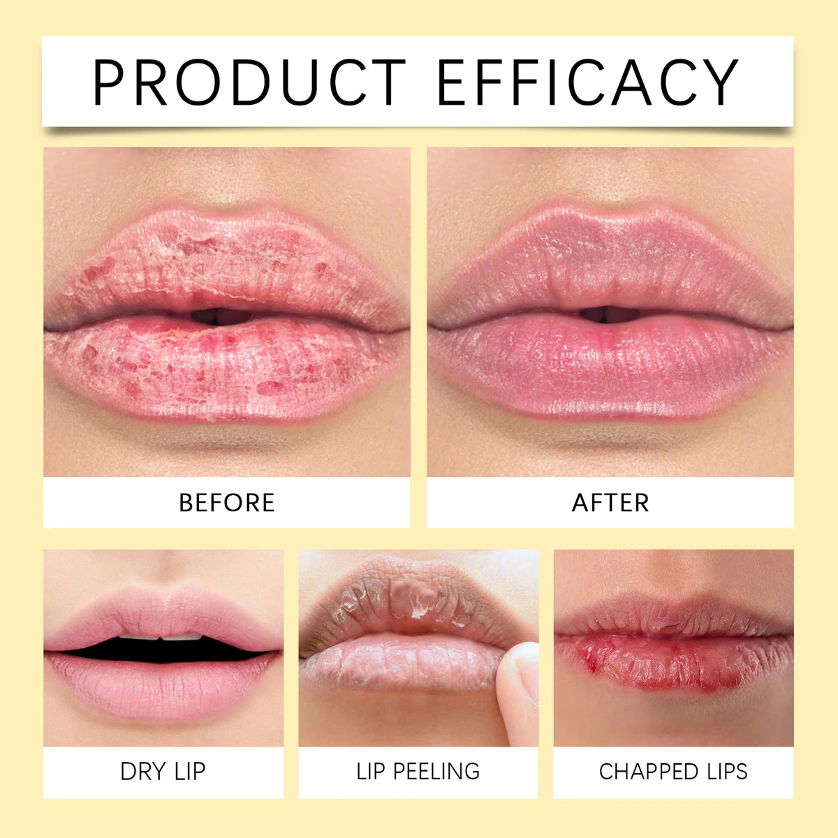 Dark Lip Care & Moisturizing Balm