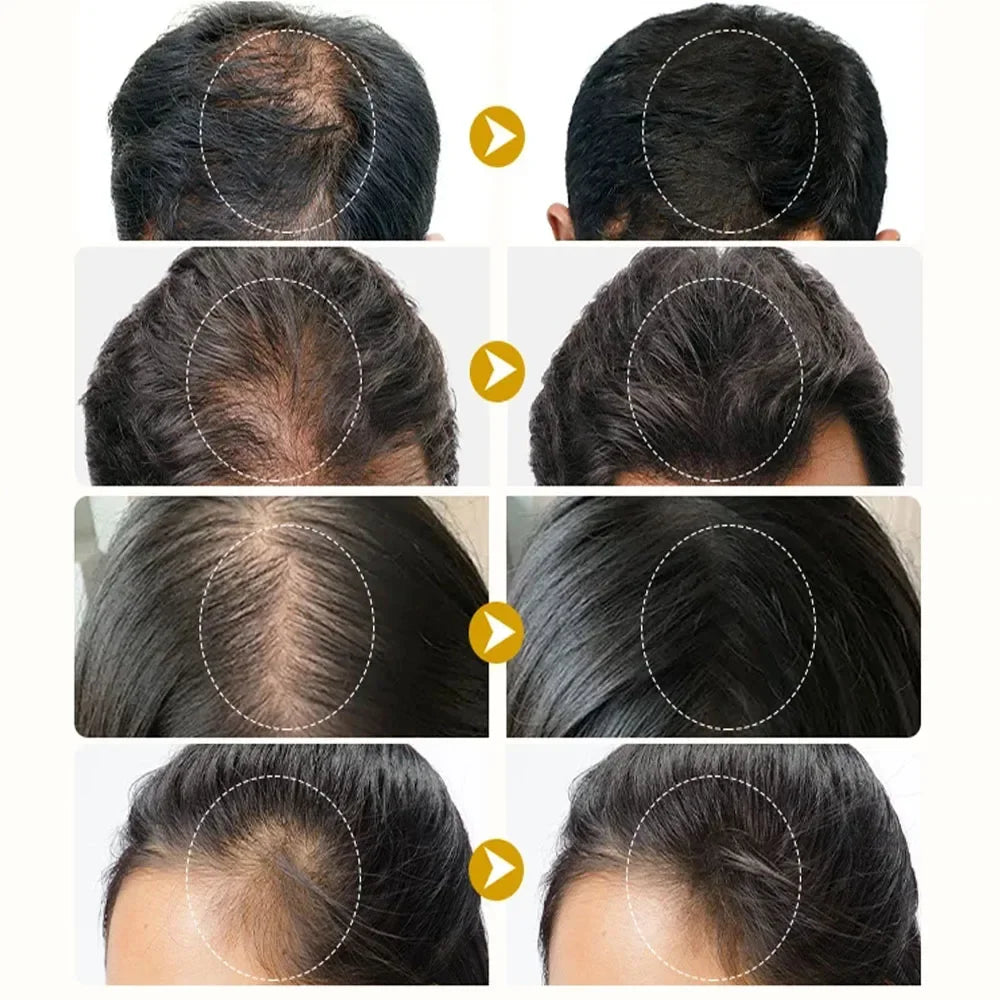 Ginger Scalp Care & Nourishing Hair Serum Spray